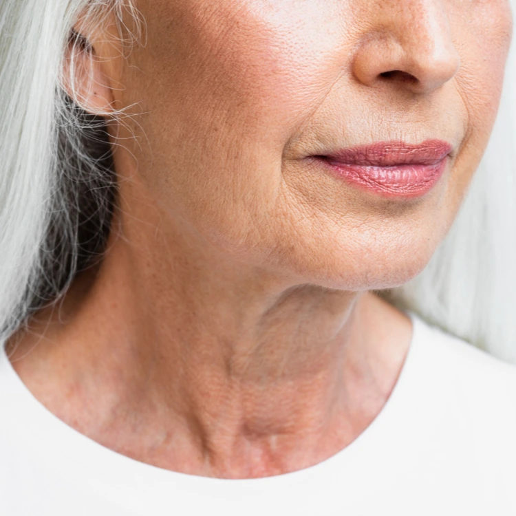 Elderly lady with wrinkles and sagging skin around her neck and jaw area.