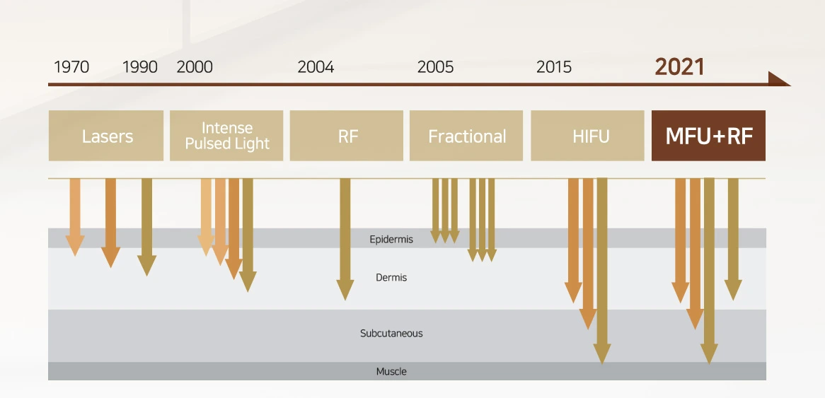 HIFU Treatment that integrates Microfocused Ultrasound (MFU) with Radio Frequency (RF) technologies.