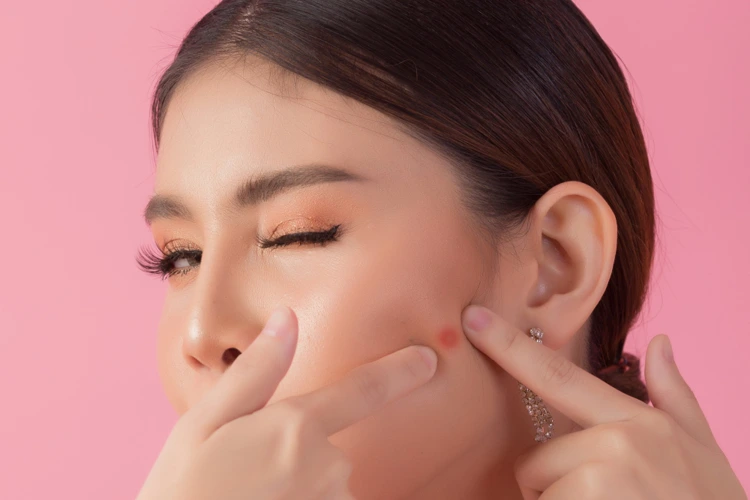 Lady using her 2 fingers to indicate an acne spot on her face.