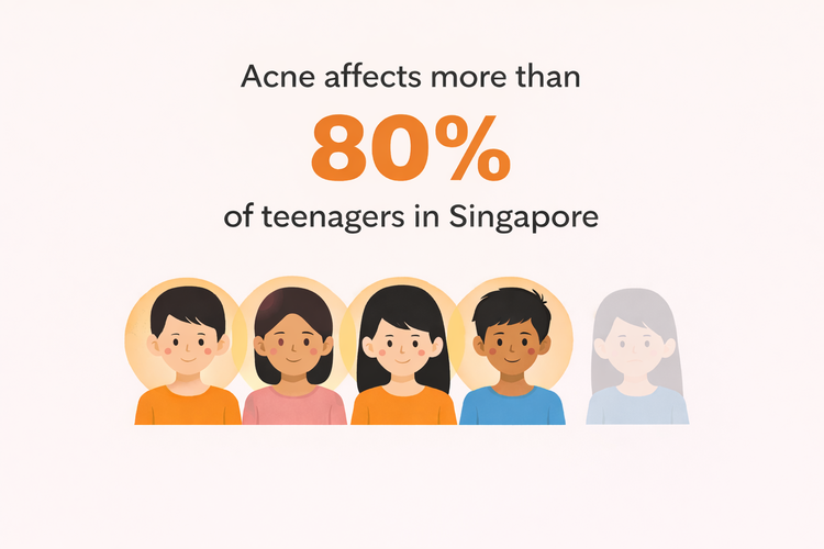 Illustration showing acne affects more than 80% of teenagers in Singapore.