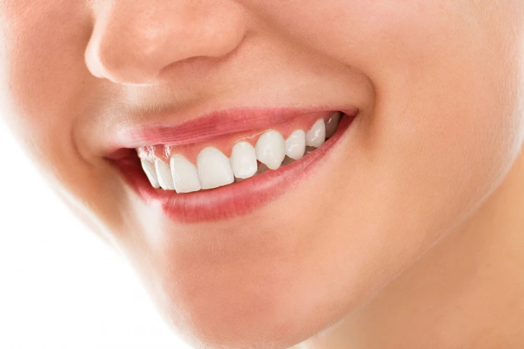 Lady revealing her white and healthy teeth while smiling.